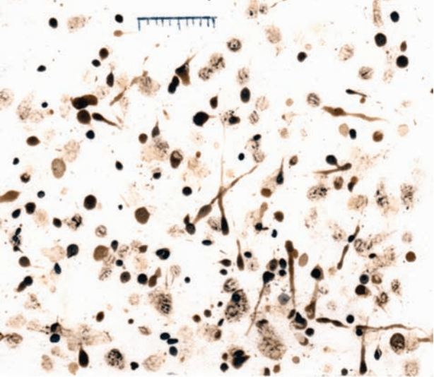 This image is a combination of  fly poop flecks and vomit spots on a wall. PC:  