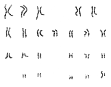 Human male karyotype, courtesy of the Human Genome Project, via Wikipedia.
